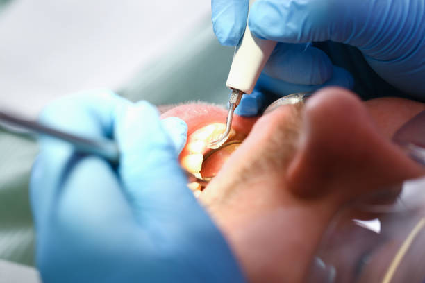 Best Urgent Care for Lost Fillings or Crowns in Lorton, VA
