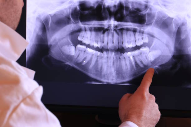 Best Emergency Tooth Extraction in Lorton, VA