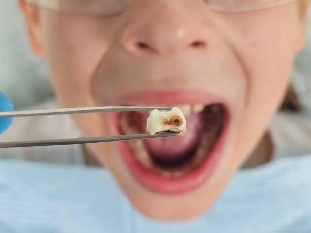Best Weekend Emergency Dentist in Lorton, VA